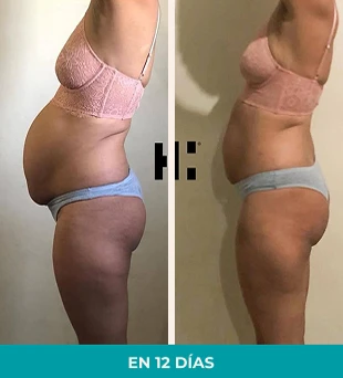 Antes y despues (Con tiempo) (4)