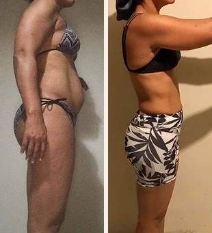 Antes y despues_ (11)